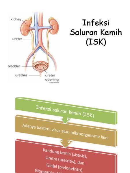 Gejala dan Pencegahan Infeksi Saluran Kemih oleh Dokter Urologi di Kendari 1727891260