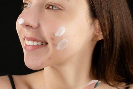 Mengapa Niacinamide Malah Picu Jerawat? Ini 6 Penyebabnya