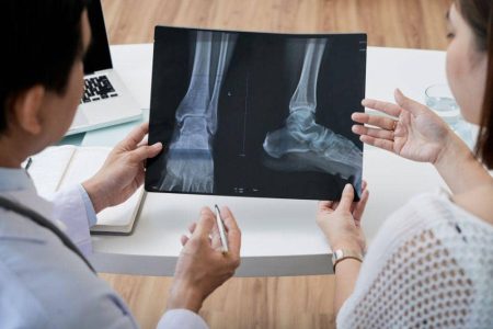 Artritis Septik: Pengertian, Gejala, Penyebab, dan Pengobatan Aa1vcatt