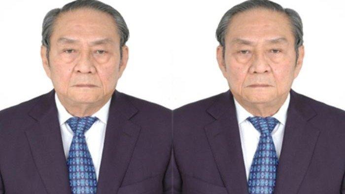 Michael Bambang Hartono Dirawat, Apa Riwayat Kesehatannya?