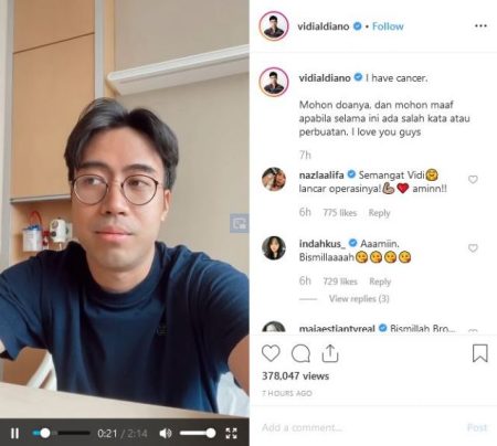 Mengenal Dampak Kemoterapi Kanker Ginjal, Vidi Aldiano Pernah Mau Berhenti Sebelum Meninggal