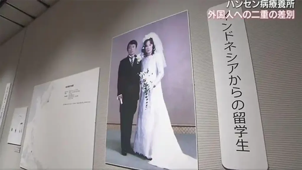 Pameran di Tokyo ungkap diskriminasi pasien kusta asing, ada perempuan Indonesia